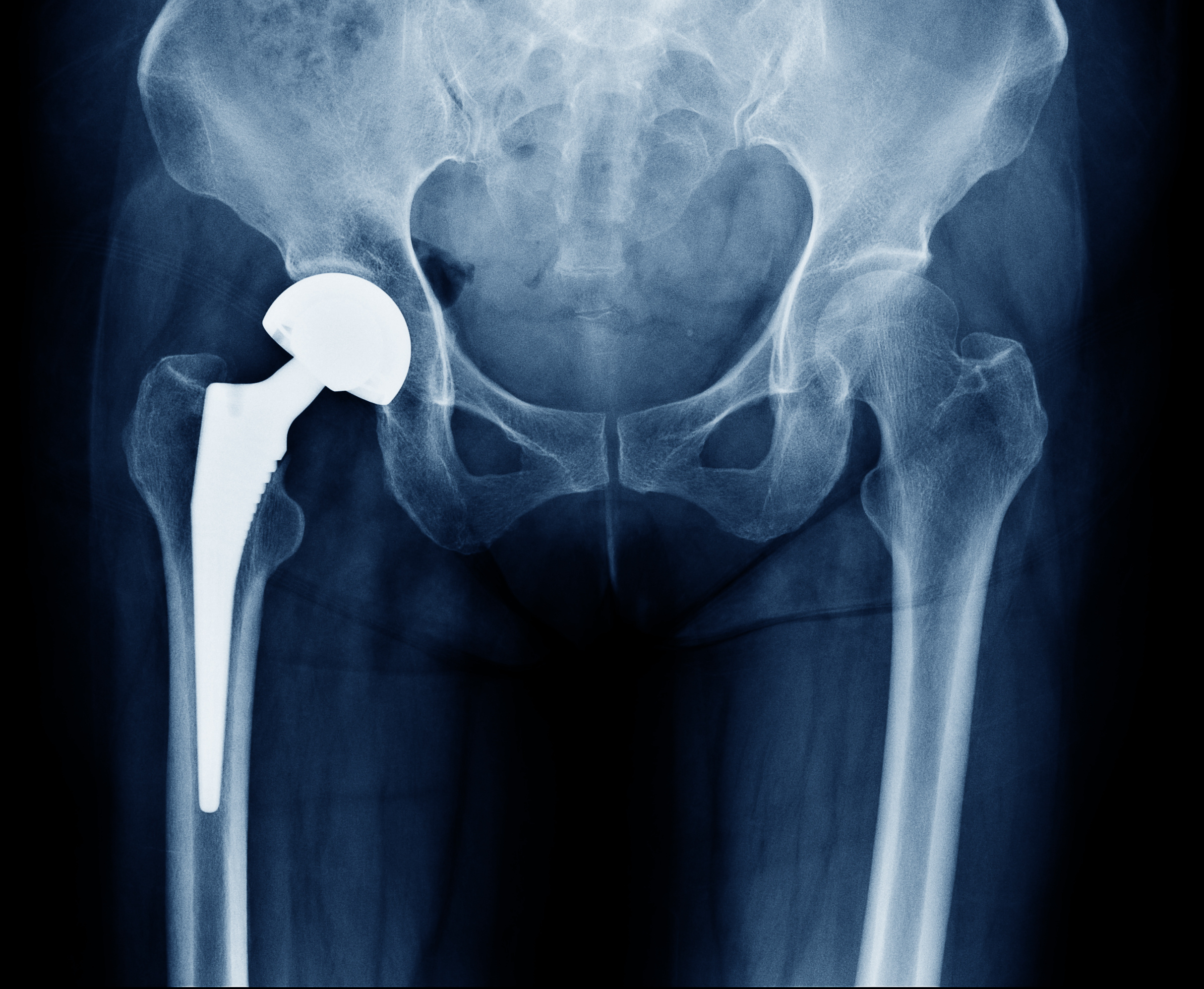 What Do My Joints Hurt Is It Arthritis Teach And Learn